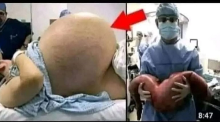 😱 She cried with happiness, they told her she was pregnant with triplets, but the… See more